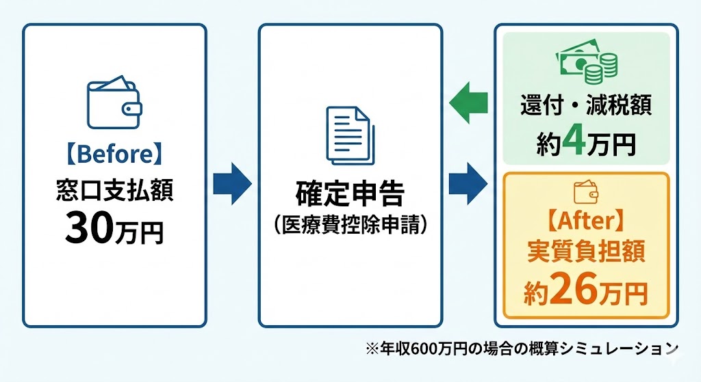 医療費控除のシミュレーションフロー図。窓口で30万円を支払った後、確定申告（医療費控除申請）を行うことで約4万円の還付・減税があり、最終的な実質負担額が約26万円になることを示す図。（年収600万円の場合の概算）