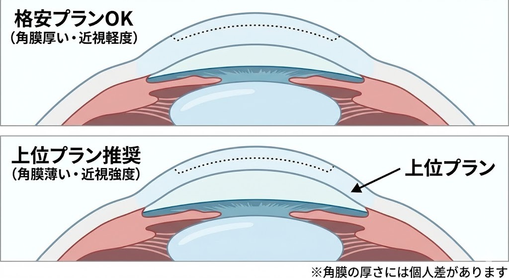 医師監修】札幌のレーシック費用相場！安さの理由と失敗しない眼科選び