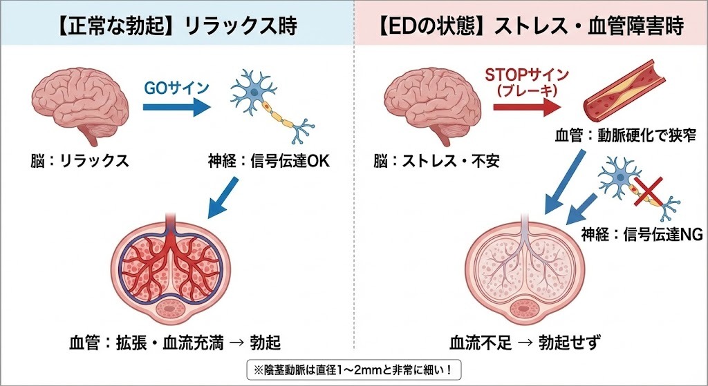正常な勃起とED状態を比較した図。リラックス時は脳から神経を通じて血管が拡張し勃起する一方、ストレスや動脈硬化があると脳のブレーキが働き、神経伝達や血流が阻害され勃起しない仕組みを示している。