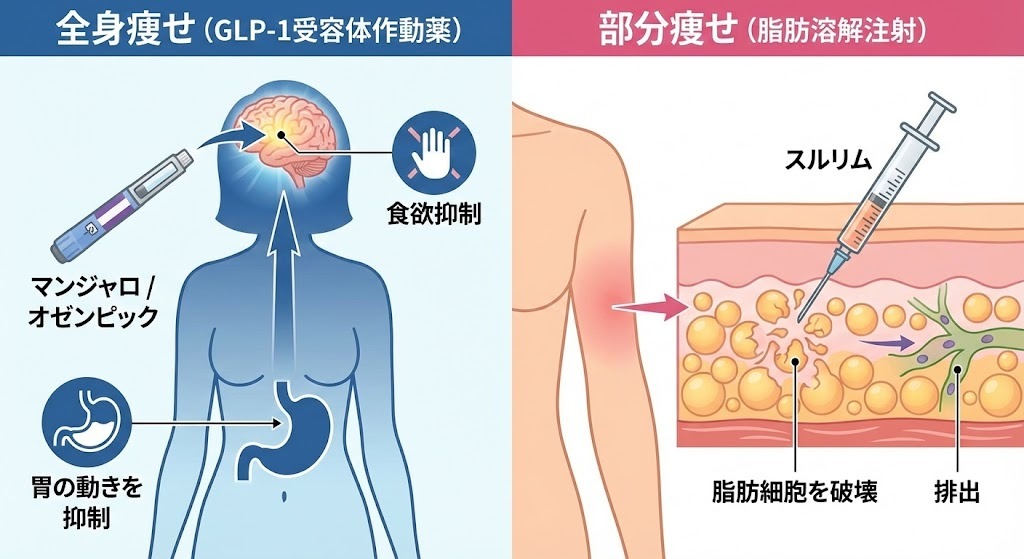 全身痩せのGLP-1受容体作動薬（マンジャロ・オゼンピック）が脳の食欲中枢に作用する仕組みと、部分痩せのスルリム（脂肪溶解注射）が皮下脂肪細胞を直接破壊する仕組みの比較図解