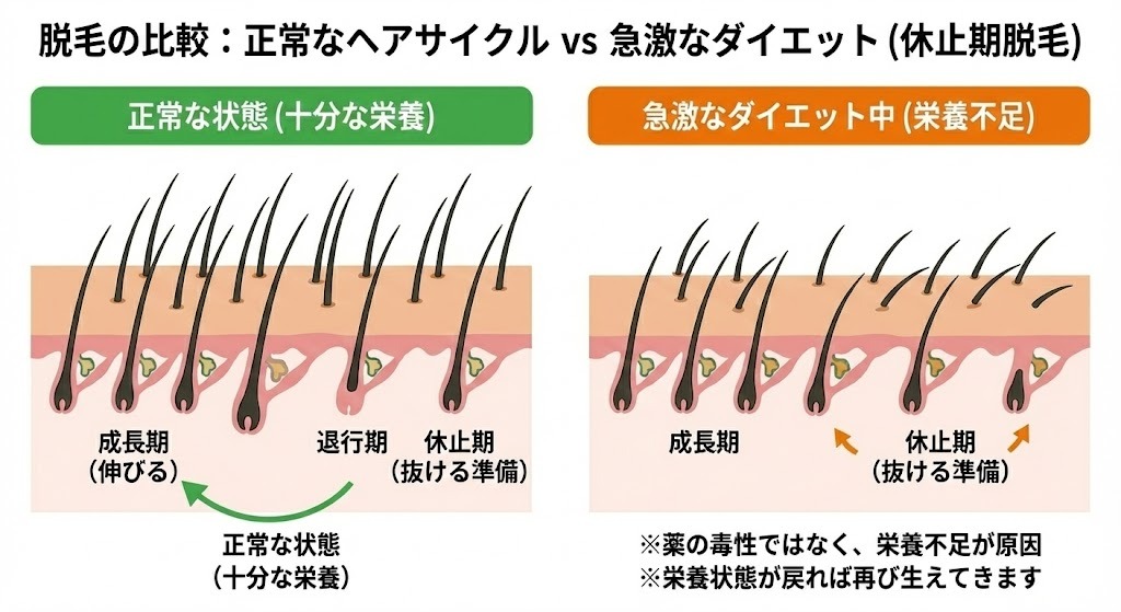 正常なヘアサイクルと、急激なダイエット（栄養不足）によって多くの毛根が「休止期（抜ける準備）」に入ってしまった状態を比較した頭皮断面のイラスト。薬の毒性ではなく栄養不足が原因であること、栄養状態が戻れば再び生えてくることを説明している。