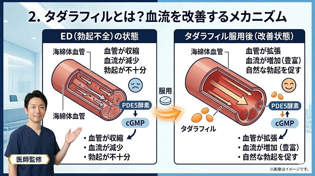 タダラフィルの血流改善メカニズム模式図。ED状態と服用後（改善状態）の海綿体血管、PDE5酵素、cGMPの作用比較。